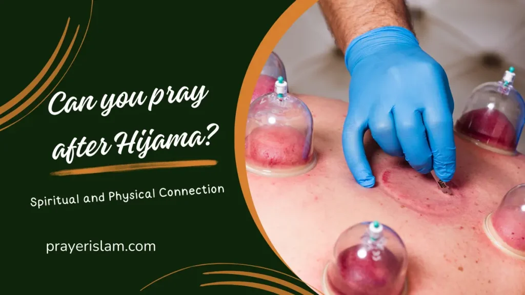 can-you-pray-after-hijama